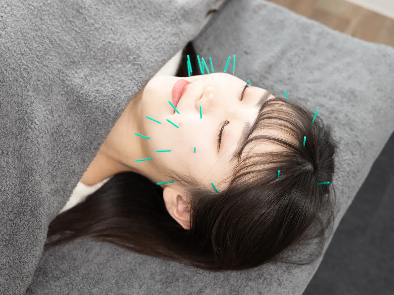 顔に鍼を打たれた女性がリラックスして横になっている様子。自律神経に働きかける美容鍼の施術風景。